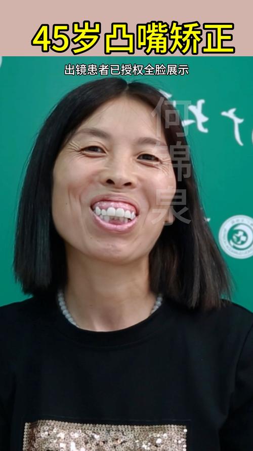 嘴凸适合什么发型_凸嘴别担心，简单几招变好看！