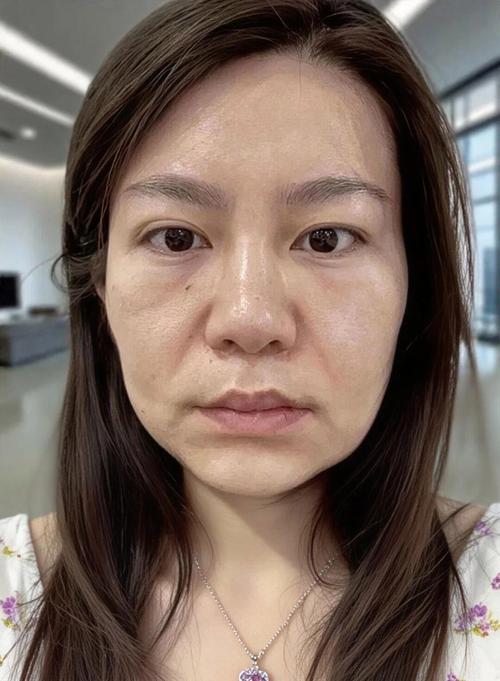 扎头发会导致脸部皮肤松弛吗_扎头紧伤头皮发际线?别太用力! 扎头发会导致脸部皮肤松弛吗_扎头紧伤头皮发际线?别太用力!