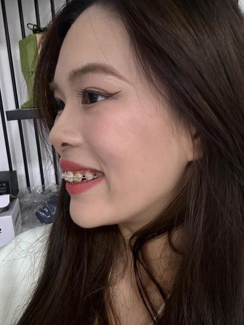 嘴特别凸适合什么发型_男生女生这样选就对了！