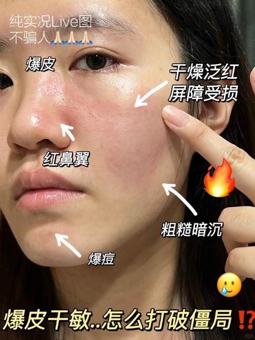 长期化妆的危害_化妆品伤皮肤？选对保平安！