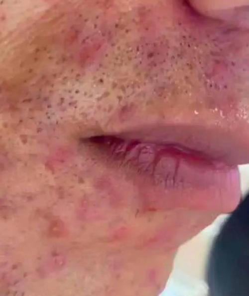 长期使用化妆品危害_长期用化妆品小心伤皮肤！