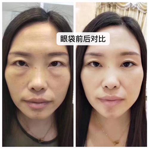 大眼袋女生化妆全过程_眼袋黑眼圈遮瑕攻略 大眼袋女生化妆全过程_眼袋黑眼圈遮瑕攻略