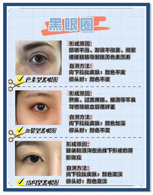 去黑眼圈眼袋小妙招_冷敷眼霜睡好，缓解浮肿黑眼圈