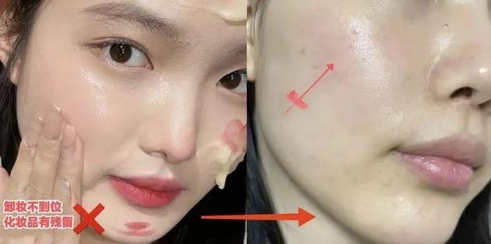 长期化妆和不化妆那种皮肤好_化妆好还是素颜好?皮肤保养看个人! 长期化妆和不化妆那种皮肤好_化妆好还是素颜好?皮肤保养看个人!