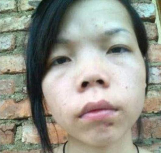 不化妆照片鼻子看着不挺_不化妆鼻子塌?医美或真管用! 不化妆照片鼻子看着不挺_不化妆鼻子塌?医美或真管用!