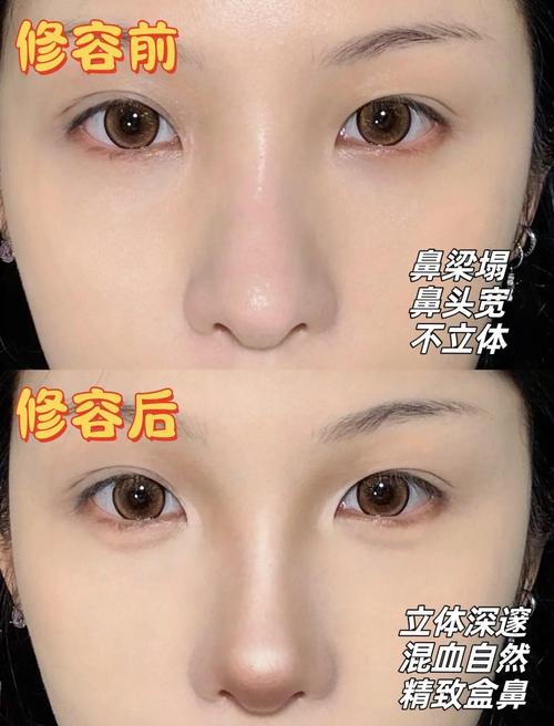 通过化妆可以让鼻子变挺吗_化妆技巧让你的鼻子变挺！