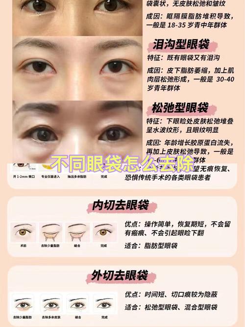 三天消除眼袋小妙招_天然方法去眼袋,告别熊猫眼 三天消除眼袋小妙招_天然方法去眼袋,告别熊猫眼