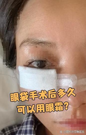 内切眼袋多久可以化妆_内切眼袋3-5天可化妆,注意轻柔温和,恢复因人而异 内切眼袋多久可以化妆_内切眼袋3-5天可化妆,注意轻柔温和,恢复因人而异