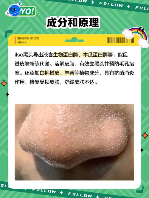 黑头导出液的正确使用方法_水杨酸黑头导出液怎么用？温和清洁防刺激