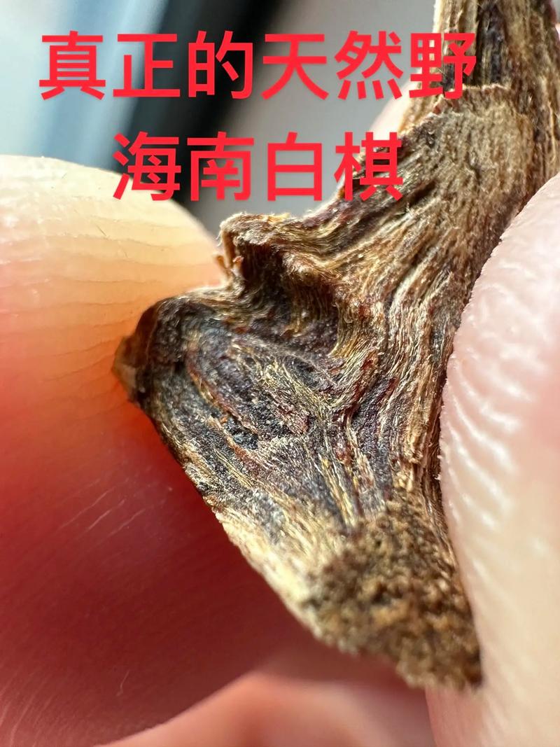 野白泛黄是什么原因导致_白带眼白发黄？原因与调理