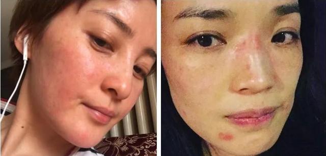 频繁化妆的人皮肤不好吗_慎用化妆品,呵护健康肌肤 频繁化妆的人皮肤不好吗_慎用化妆品,呵护健康肌肤