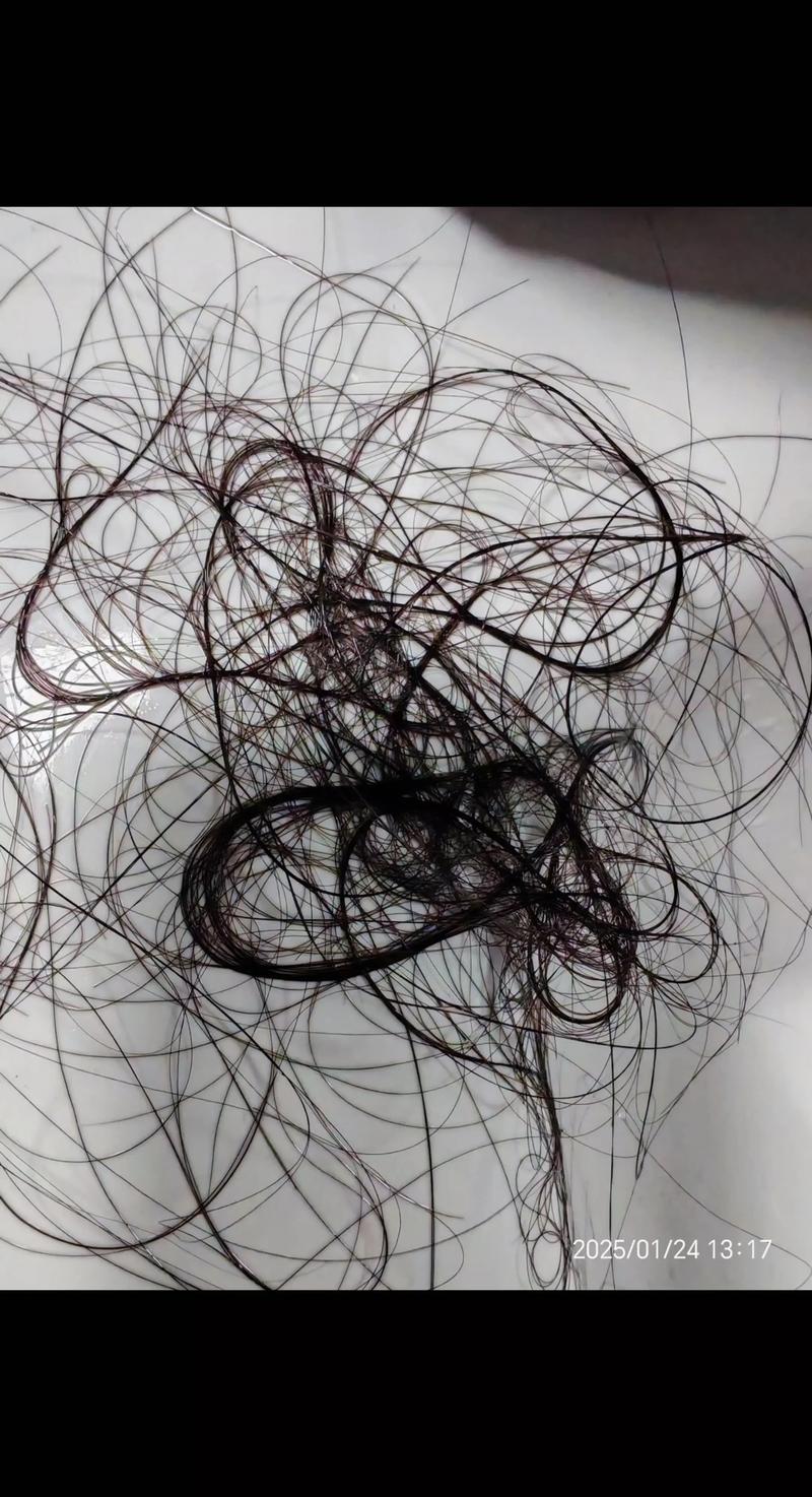 染完头发后掉发严重_染发掉发怎么办?护发小妙招! 染完头发后掉发严重_染发掉发怎么办?护发小妙招!