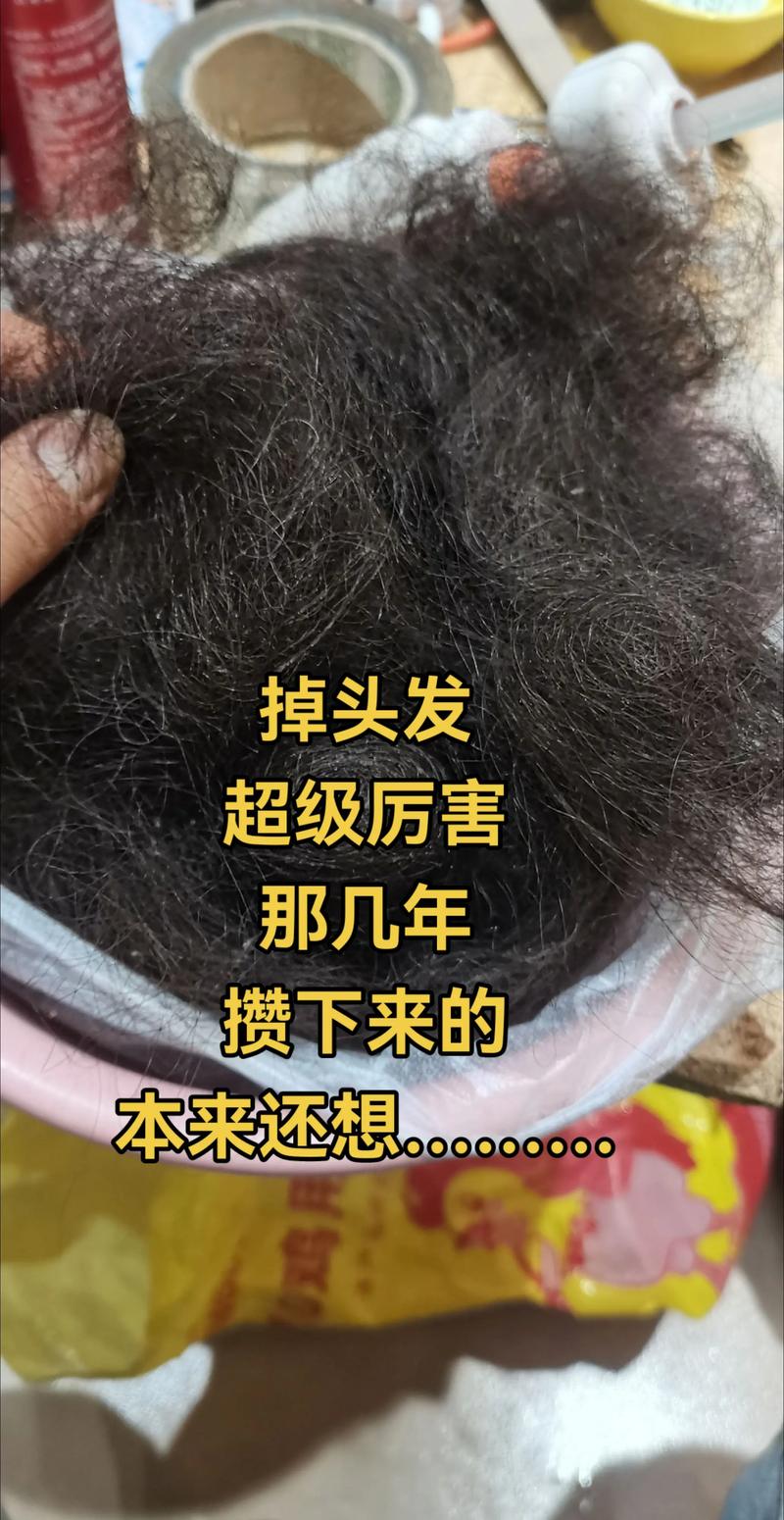 捋头发总掉一两根正常吗_掉发增多?别慌,正常现象! 捋头发总掉一两根正常吗_掉发增多?别慌,正常现象!