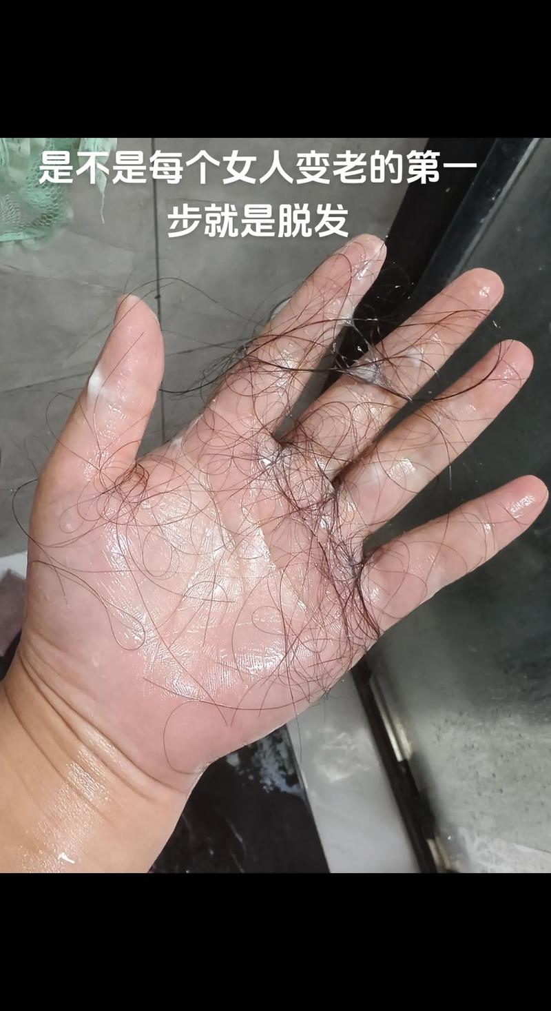 青少年掉头发正常吗_青少年掉发多?别慌,日常护理来帮忙! 青少年掉头发正常吗_青少年掉发多?别慌,日常护理来帮忙!