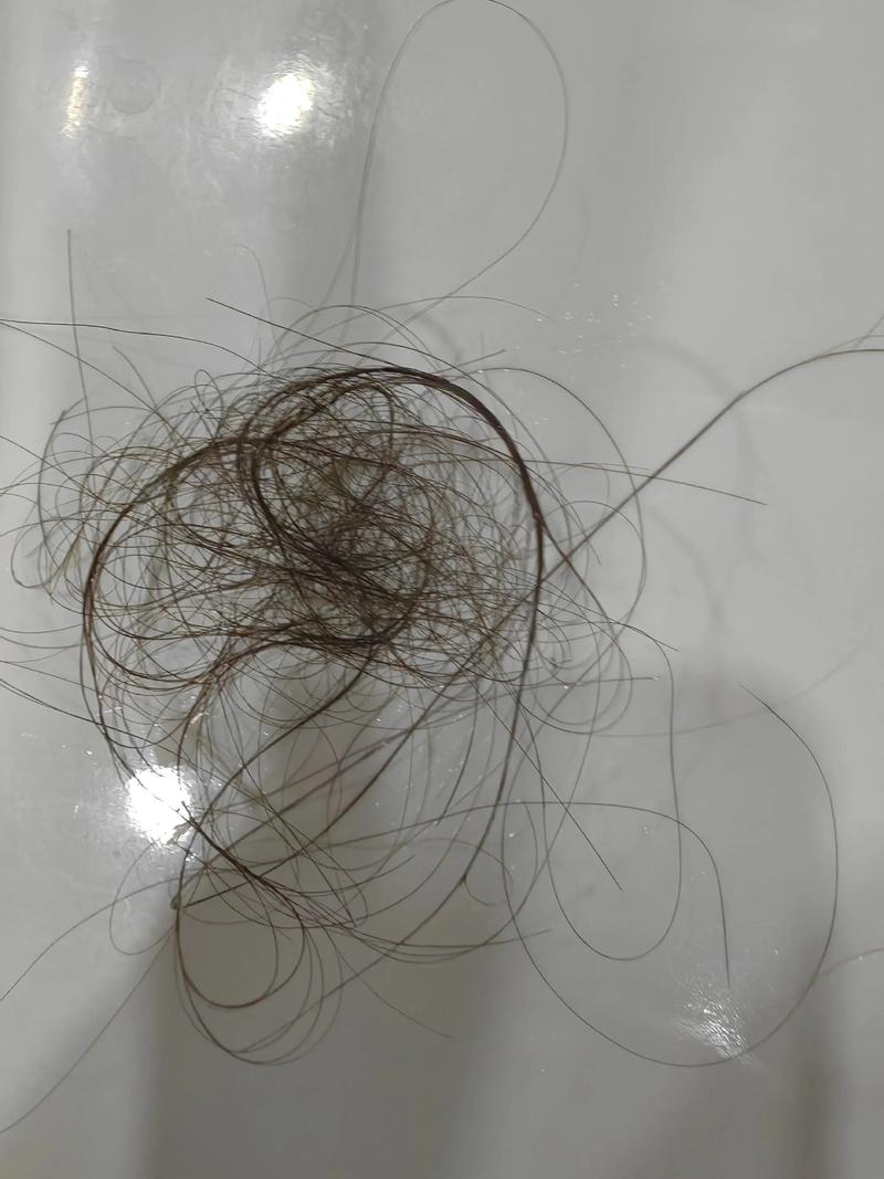 洗一次头掉100根头发正常吗_每天掉发50-100根正常，洗头时掉得多别担心