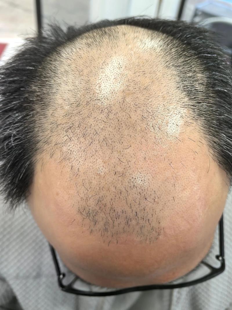 十五天头发长度明显吗_头发长得慢?营养睡眠是关键! 十五天头发长度明显吗_头发长得慢?营养睡眠是关键!