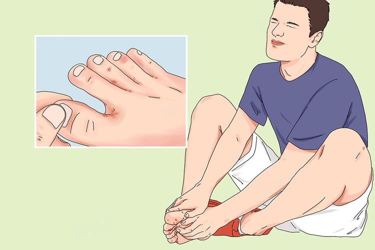 脚趾头发麻发木是什么原因_脚趾麻木原因及应对