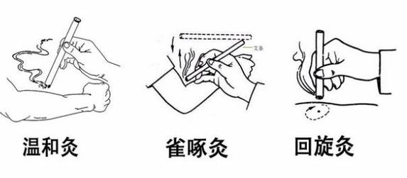 炙的方法有几种_中医古法,治病保健好选择 炙的方法有几种_中医古法,治病保健好选择