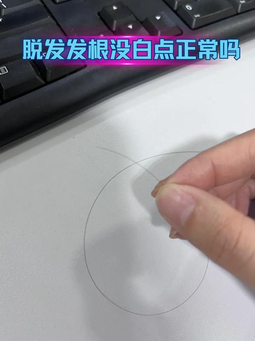 感觉头发一碰就掉发根特别松_头掉发根松？睡眠营养压力惹的祸