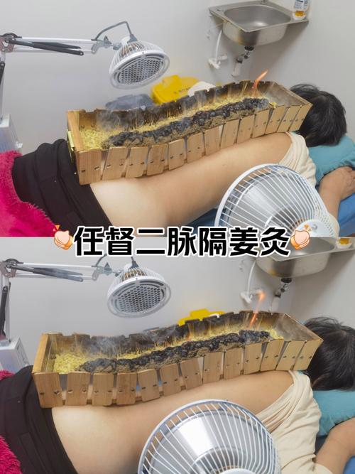 隔姜灸的操作步骤是什么_中医古老疗法，安全有效的健康之选