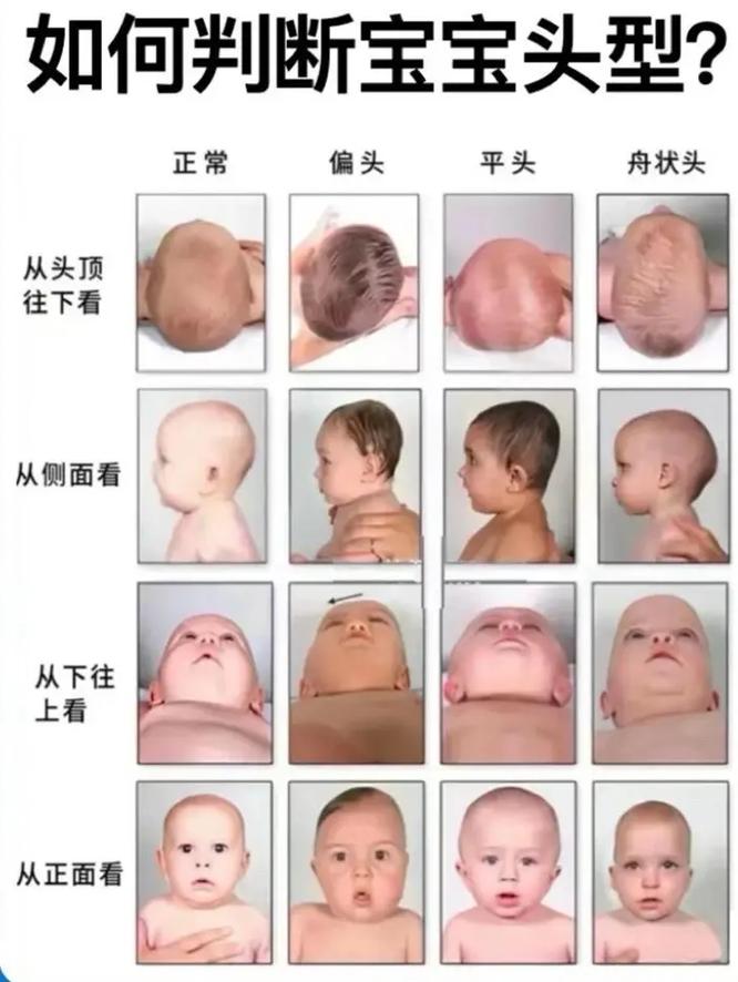 舟状头最忌三种头发型_发型妆容配饰巧用，视觉更平衡