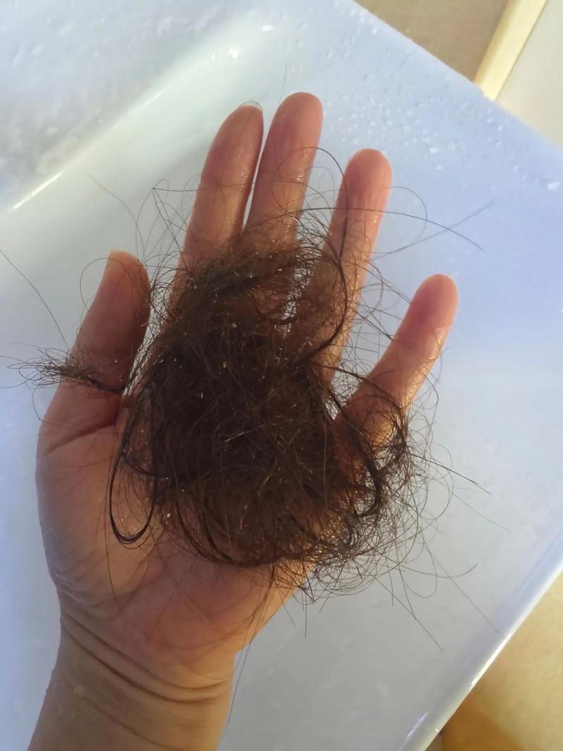 洗一次头掉50根头发正常吗_脱发50根正常？补营养护头皮可改善