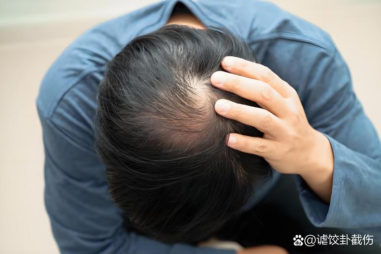 一摸头顶的头发感觉头皮痛_头皮疼?多原因导致,别大意! 一摸头顶的头发感觉头皮痛_头皮疼?多原因导致,别大意!