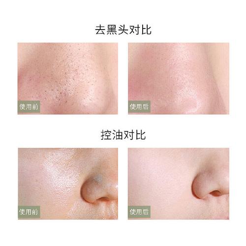 查什么化妆品让脸变白_多通路淡斑，敏感肌也适用