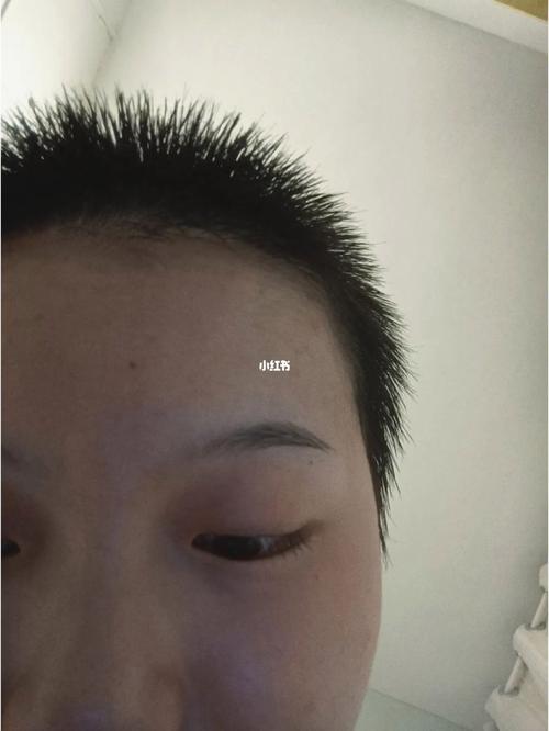 留2个月头发有多长_头发生长慢？均衡饮食加头皮护理来改善！