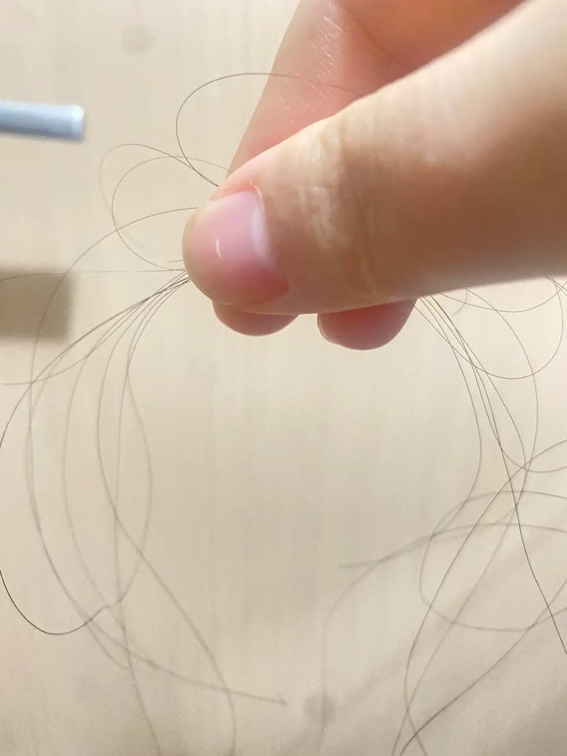 一抓头发掉好几根头发_掉发多？查查原因，健康生活防脱发