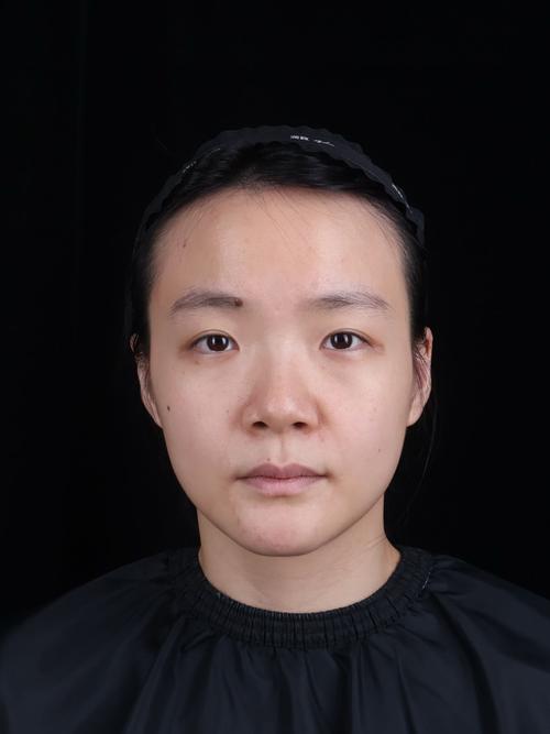 隆鼻后40天可以化妆吗_隆鼻术后多久能化妆？伤口愈合是关键