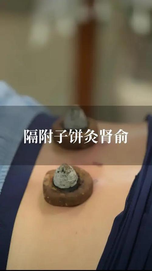 隔附子饼灸操作步骤_隔附子饼灸，中医外治，温经散寒
