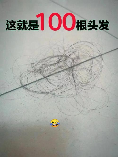 每天掉头发超过30根_每天掉30根头发正常吗? 每天掉头发超过30根_每天掉30根头发正常吗?