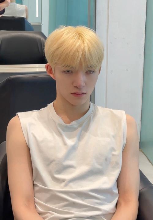 青少年头上长金色头发_遗传激素营养影响 发色变金需留意