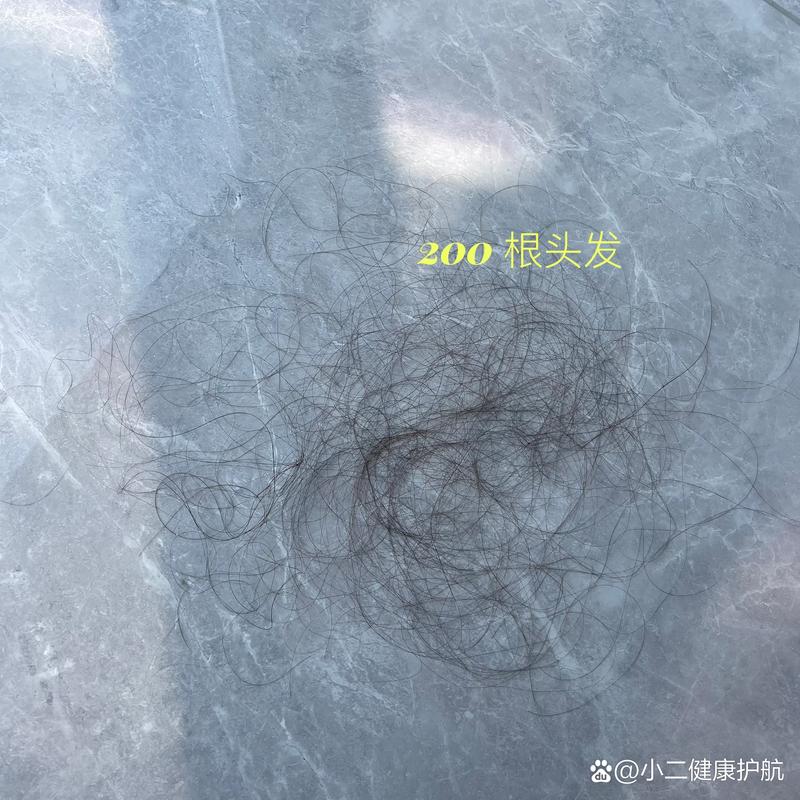 洗一次头发掉多少正常_洗头掉发正常？如何减少掉发？