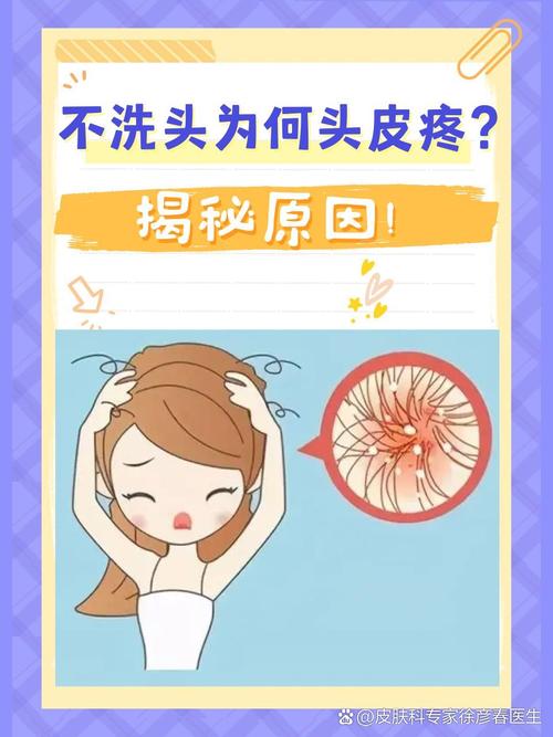 很久没洗头发头皮很痛_头痒痛?勤洗头,选温和洗发水! 很久没洗头发头皮很痛_头痒痛?勤洗头,选温和洗发水!