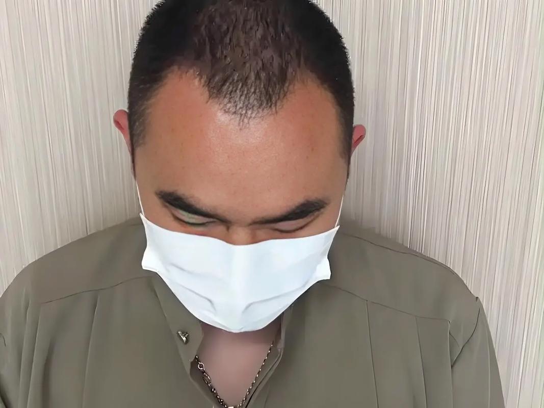 突脑门m型发型脸的轮廓凹凸_M型额头显高？发型这样修，脸小一圈！