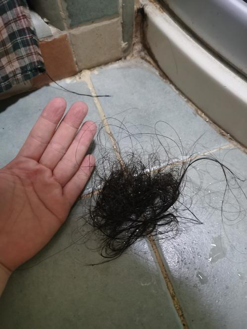 洗一次头发掉50根正常吗_洗头掉50根正常，太多需留意