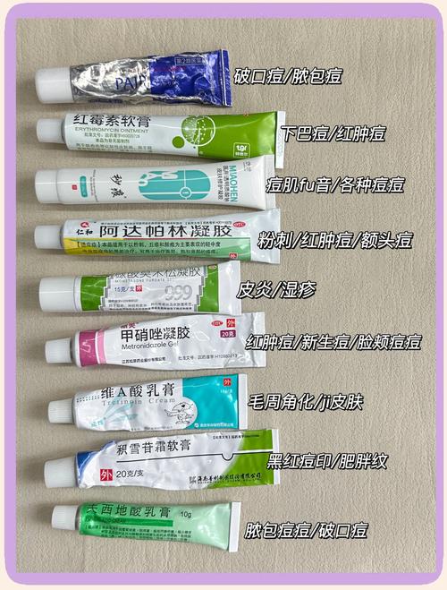 痤疮可以用油性化妆品吗_选对化妆品是关键 痤疮可以用油性化妆品吗_选对化妆品是关键