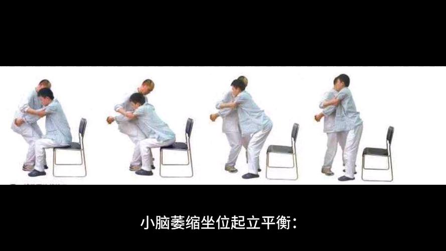 小脑萎缩锻炼方法_平衡协调步态语言认知训练