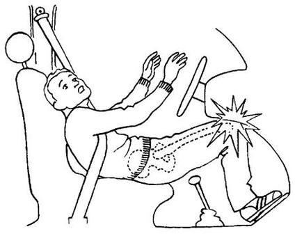 髋骨撞击最怕三个动作_髋伤注意!避免深蹲久坐,选温和运动 髋骨撞击最怕三个动作_髋伤注意!避免深蹲久坐,选温和运动