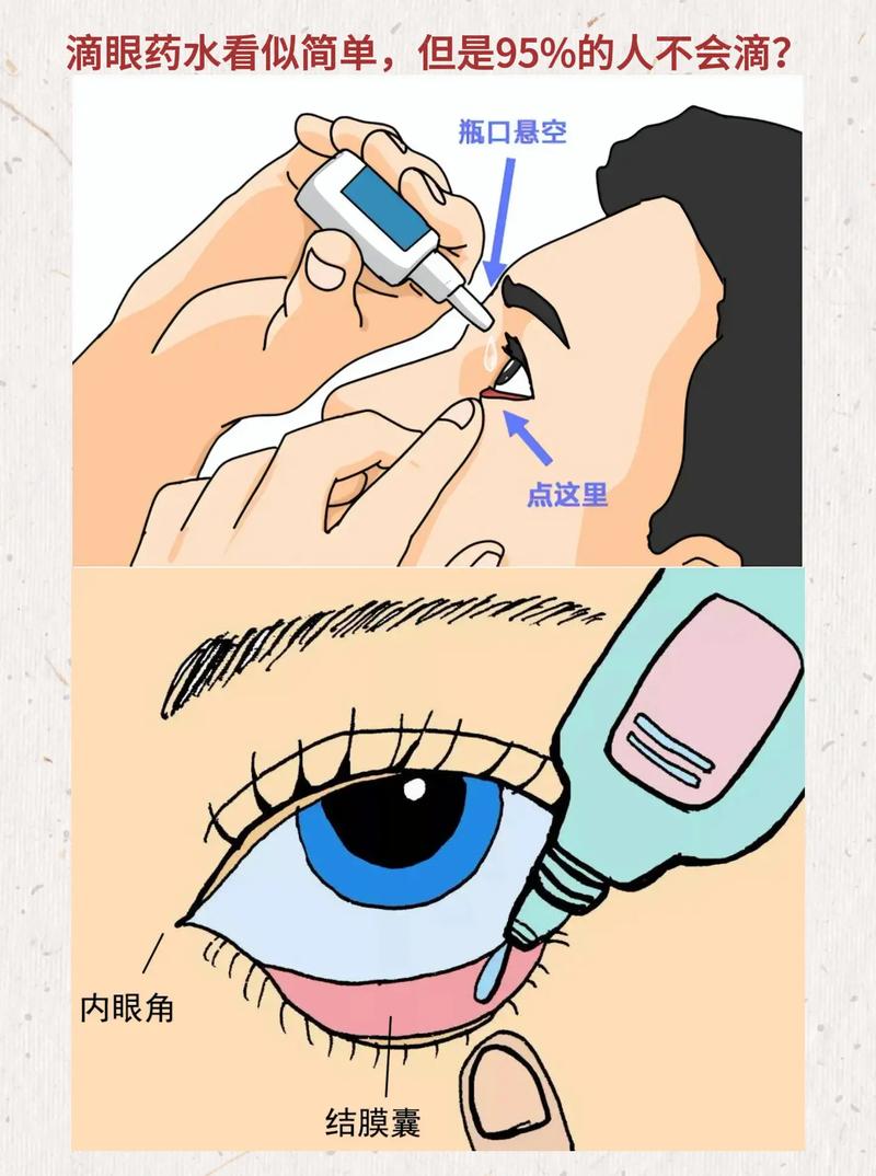 洗眼液的正确使用方法_洗眼液温和清洁,缓解眼疲劳,敏感眼适用 洗眼液的正确使用方法_洗眼液温和清洁,缓解眼疲劳,敏感眼适用