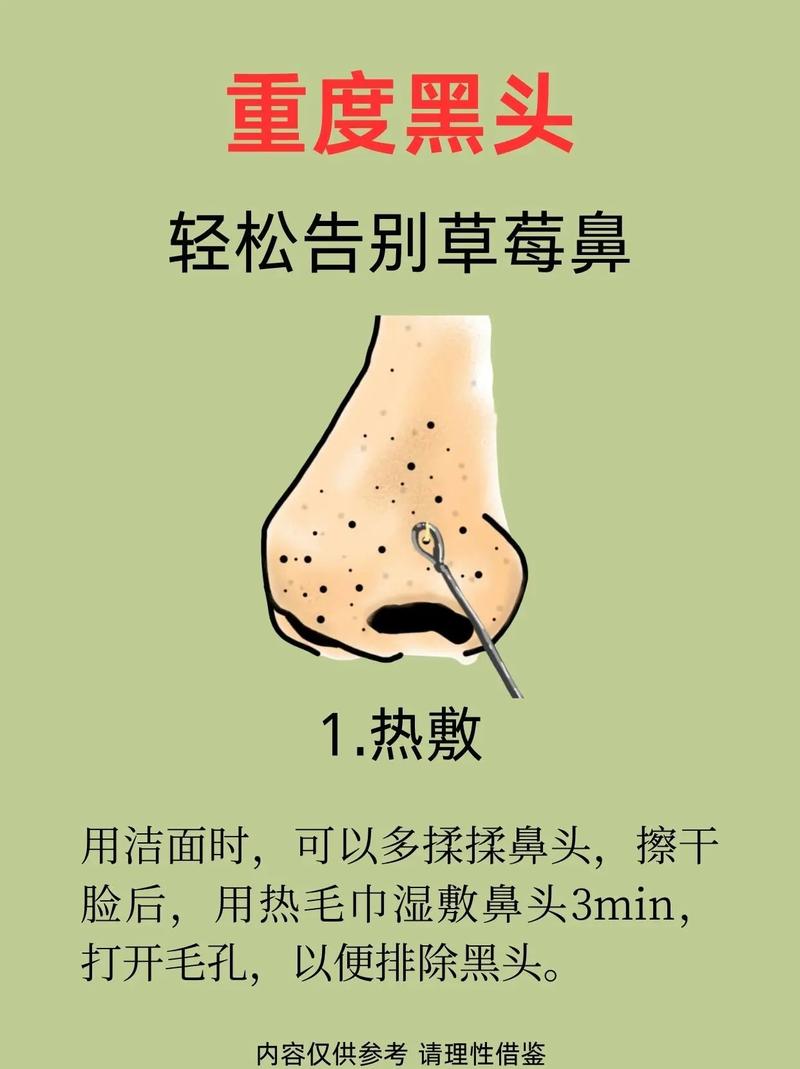 吸黑头面膜的正确使用方法_温和洁面+泥膜,一周1-2次有效吸黑头 吸黑头面膜的正确使用方法_温和洁面+泥膜,一周1-2次有效吸黑头