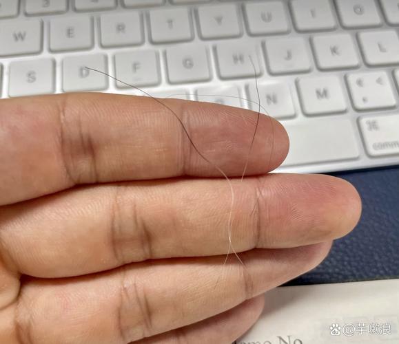 逆方向拨动头发发根痛怎么办_发根疼痛怎么办？试试这些方法！