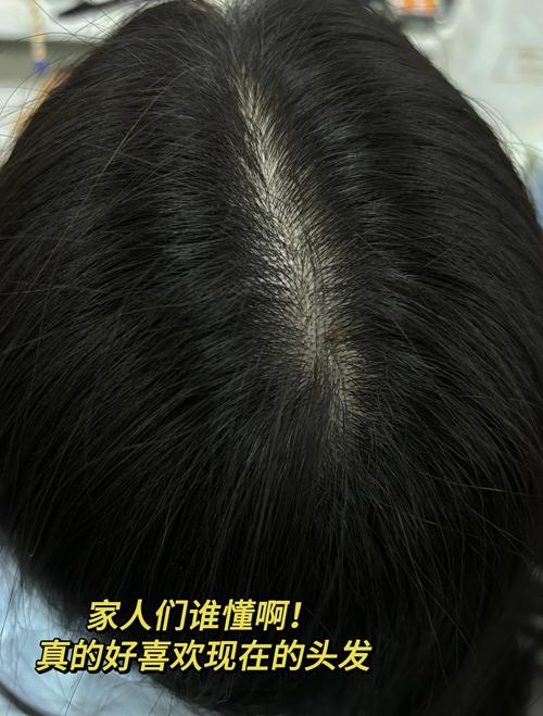 少白头还能变回黑头发吗_白发成因与调理方法