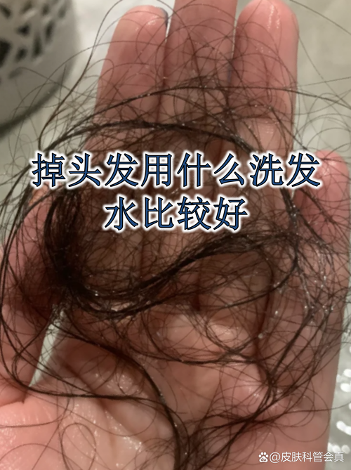 水质不好会掉头发吗_硬水伤发秃？护发妙招来啦！