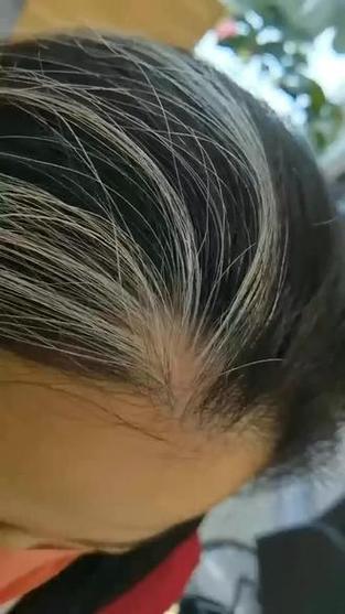 薅一根白头发会长十根吗_白发成因复杂，别再拔了，试试生活习惯调整！