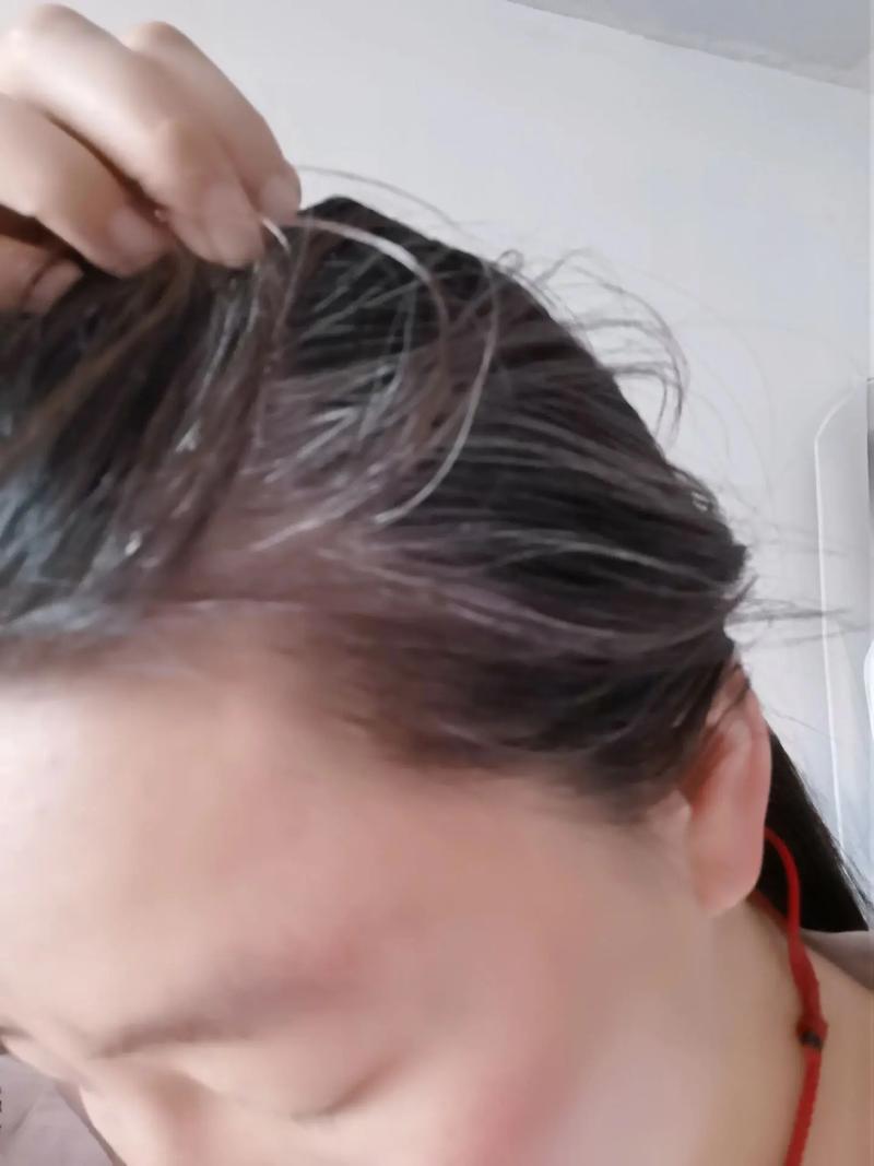 拔了一根白头发会不会长更多_别拔白发！伤毛囊，白更甚，调整生活是好方法