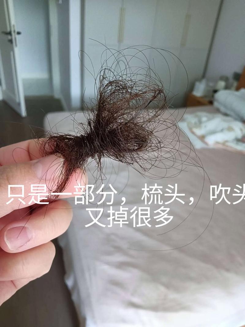 早晨一捋头发会掉很多根_梳头掉发正常,温和护理防脱发 早晨一捋头发会掉很多根_梳头掉发正常,温和护理防脱发