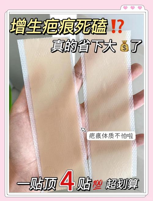 剖腹产疤痕贴正确使用方法_剖腹产疤痕贴的正确使用方法与注意事项 剖腹产疤痕贴正确使用方法_剖腹产疤痕贴的正确使用方法与注意事项